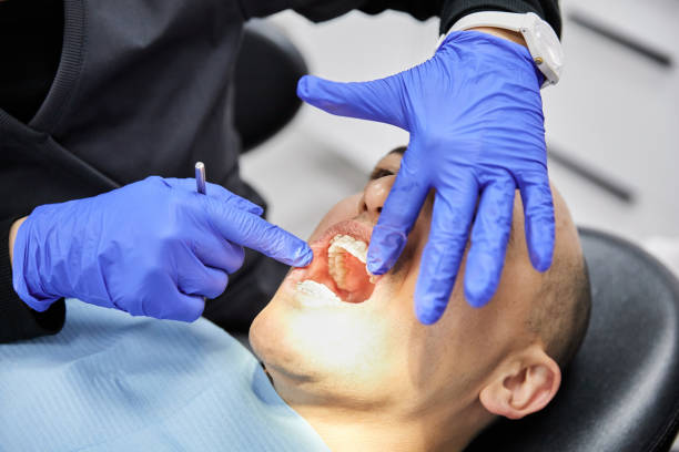 Best Emergency Wisdom Tooth Extraction in Coolidge, AZ